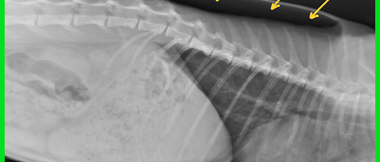 enfisema subcutáneo