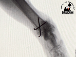 traumatología traumatología