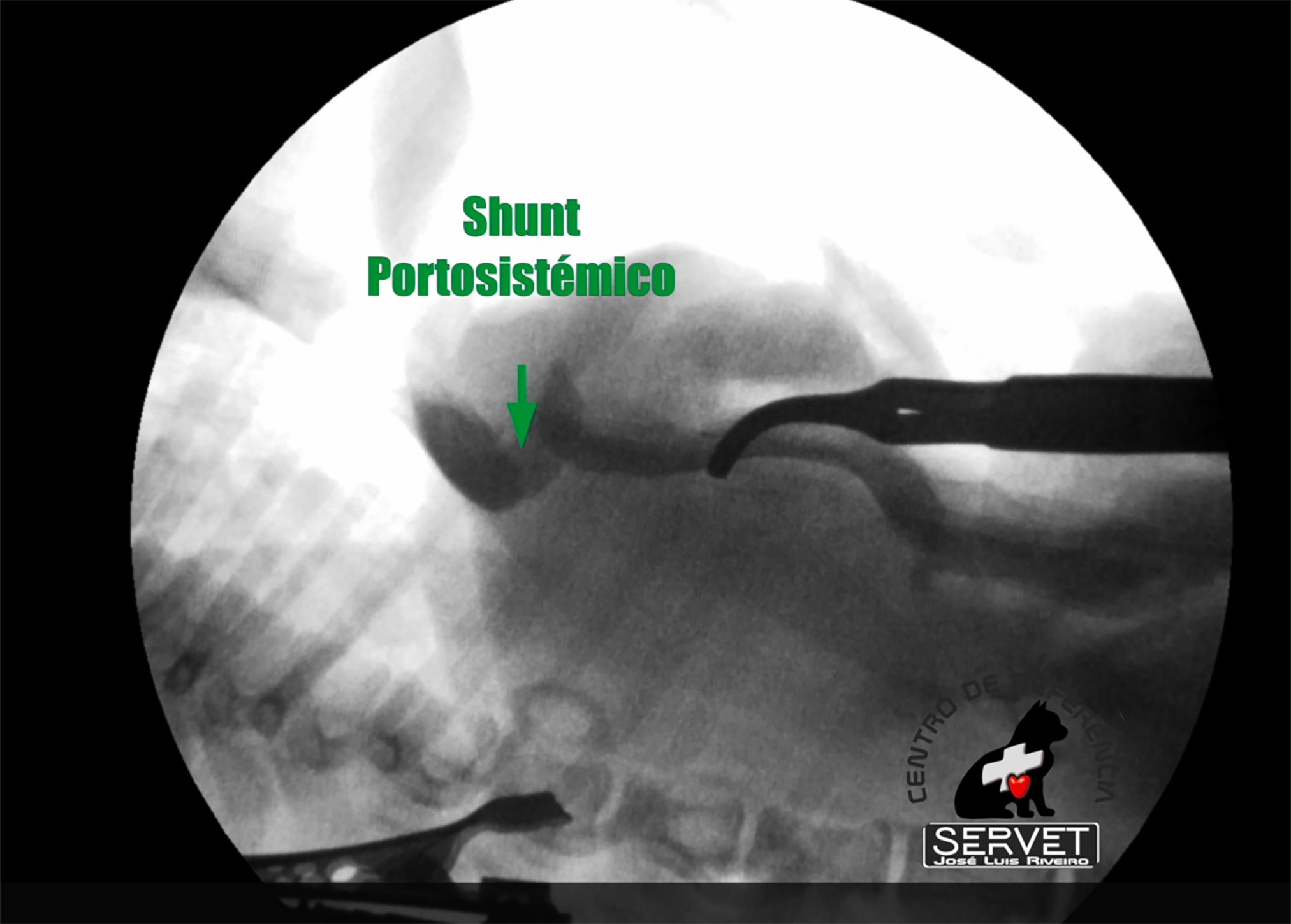 fluoroscopia fluoroscopia