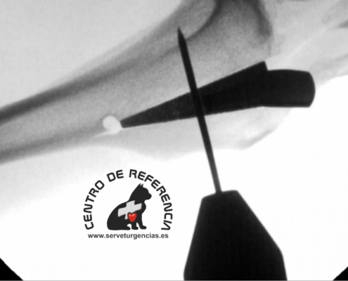 TTA con fluoroscopio