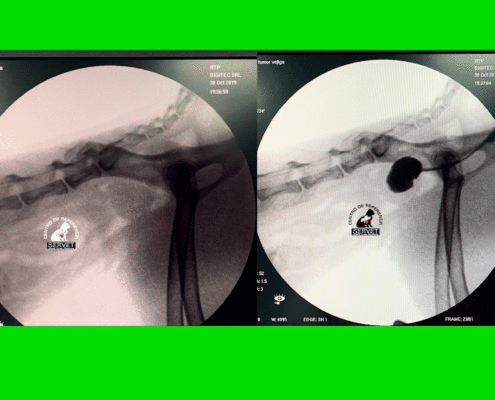 Fluoroscopia vesical con contraste