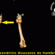 Osteocondritis disecante servet urgencias veterinarias