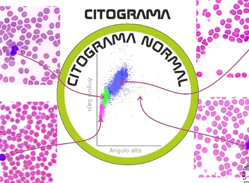 Citograma y su citología asociada