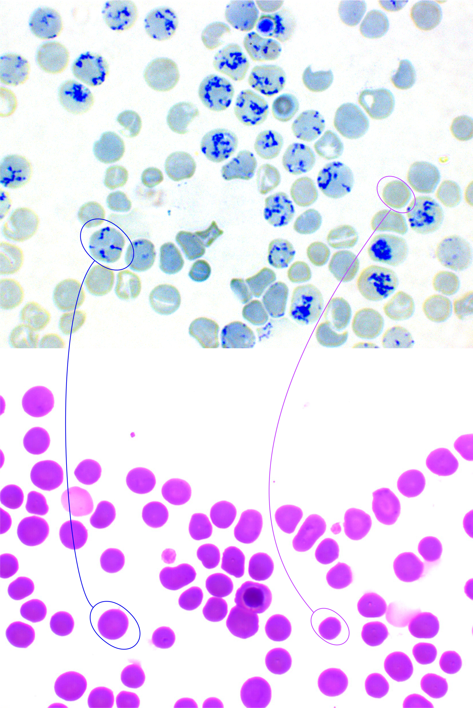 tinción vital nuevo azul de metileno
