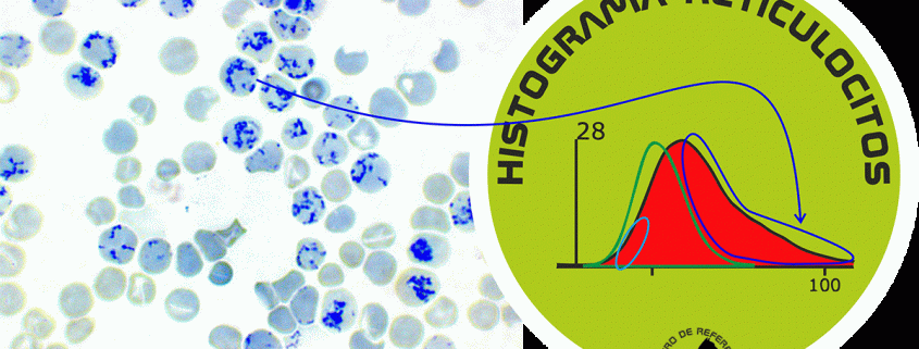 anemia regenerativa tincion vital
