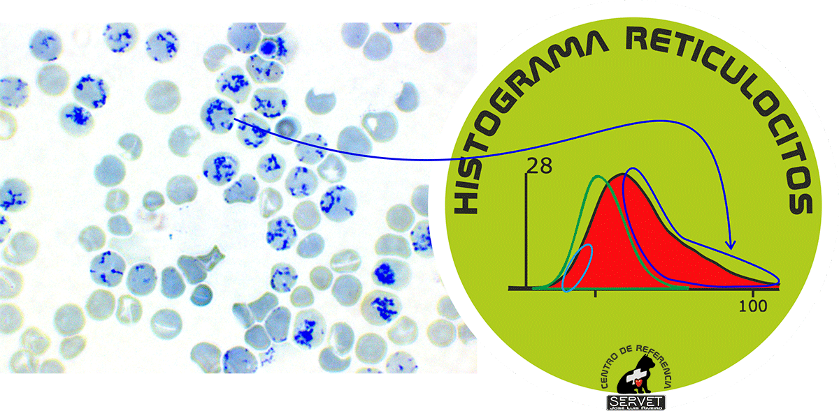 anemia regenerativa tincion vital