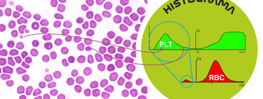 histograma de plaquetas y citologia