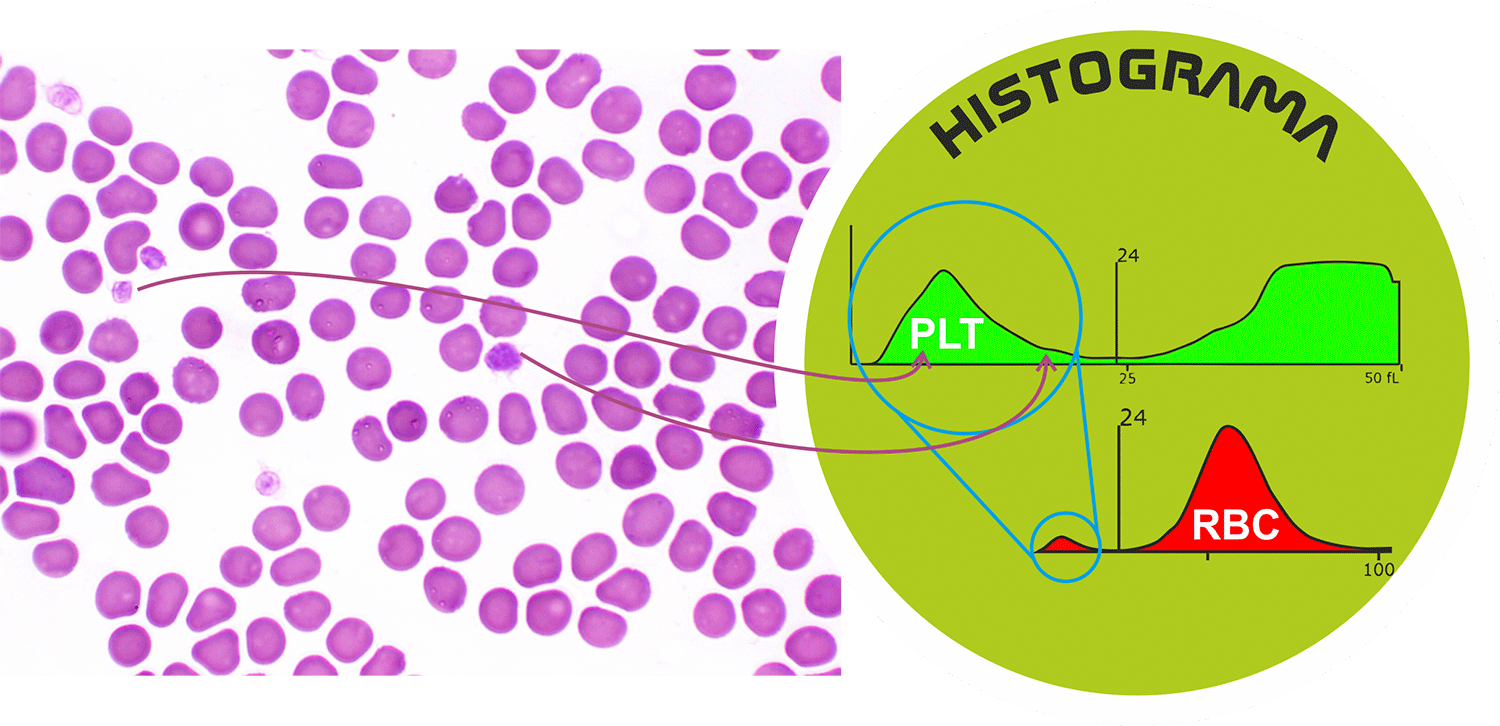 Plaquetas histograma de plaquetas y citologia