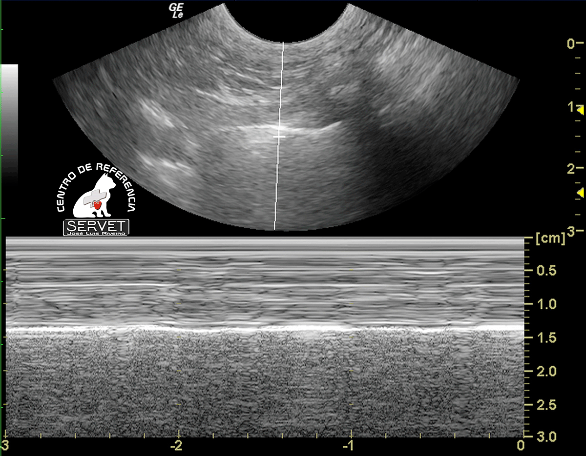seashore sign pulmón sano