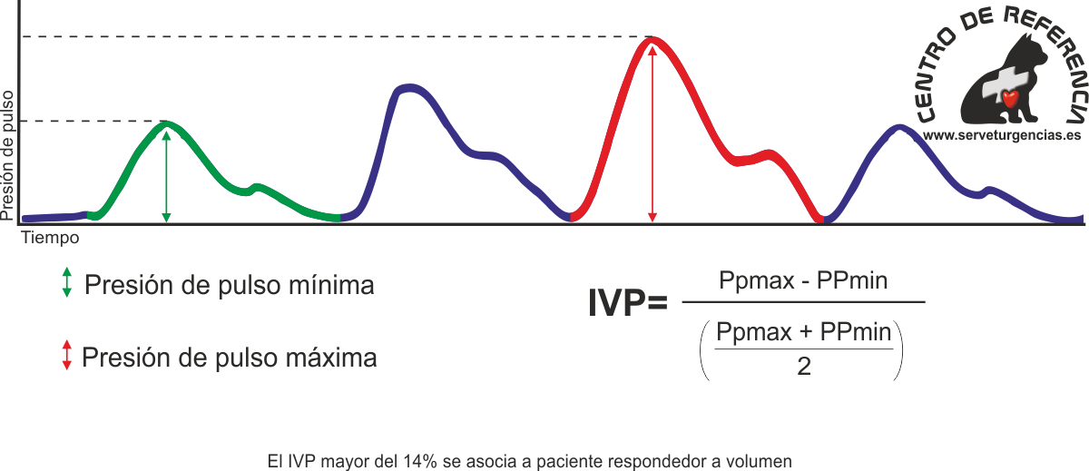 indice de variabilidad pletismográfica