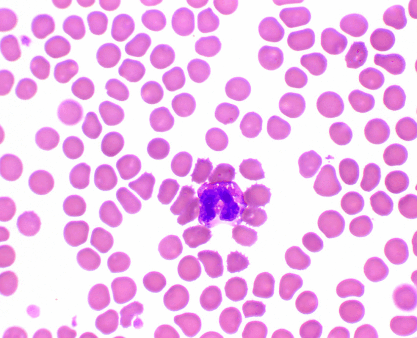 EOSINOFILOS