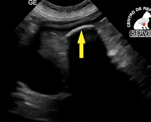Ecografía cuerpo extraño gástrico