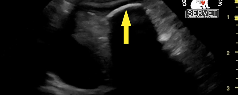 Ecografía cuerpo extraño gástrico