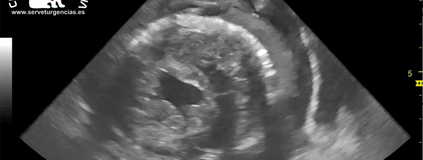 Ecografía del shock cardiogénico