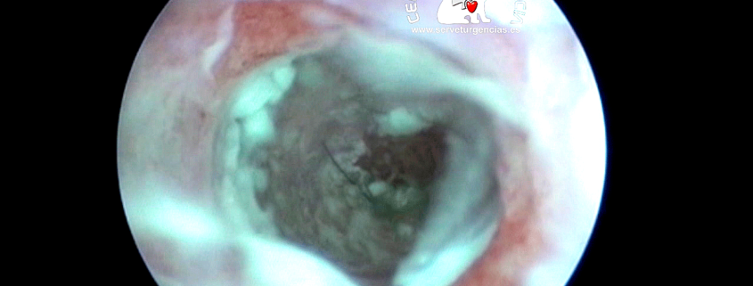 Otitis media biofilm Servet Urgencias