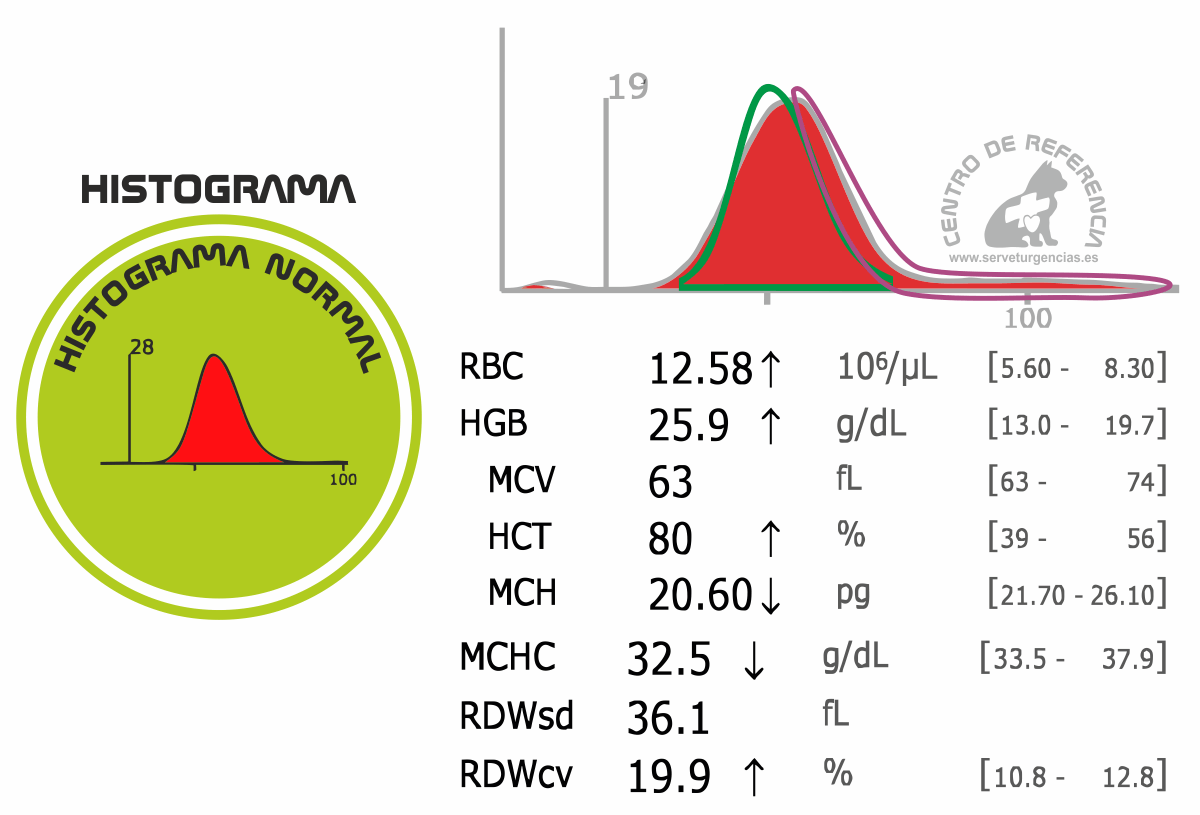 policitemia vera Policitemia vera histograma
