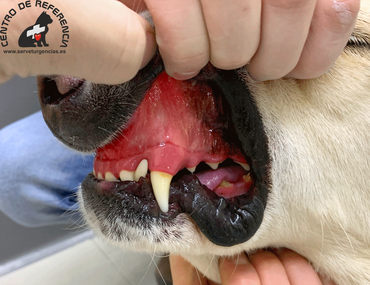 policitemia-vera Policitemia vera