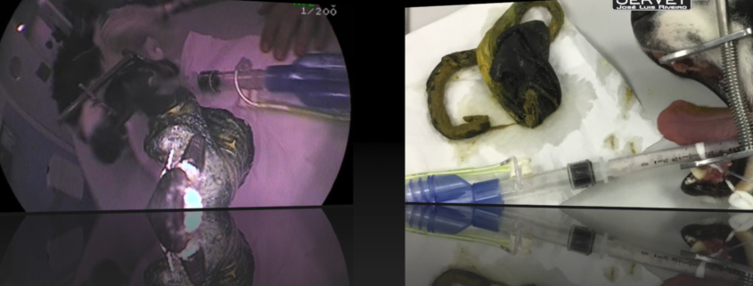 Cuerpo extraño ecografía y endoscopia