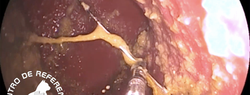 Endoscopia aguja estómago