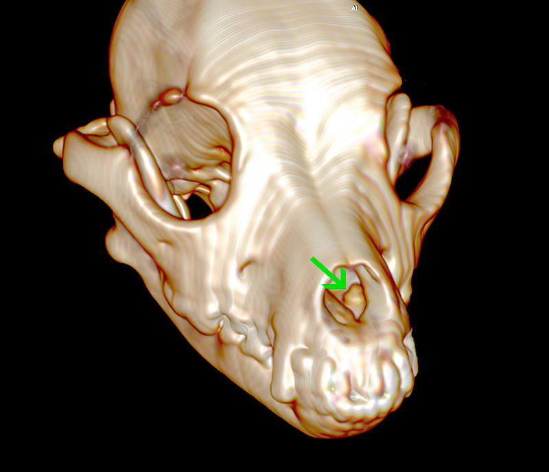 11 tac 3d preoperatorio